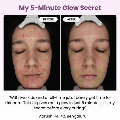 Micro Infusion Glow Kit