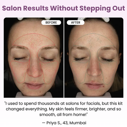 Micro Infusion Glow Kit